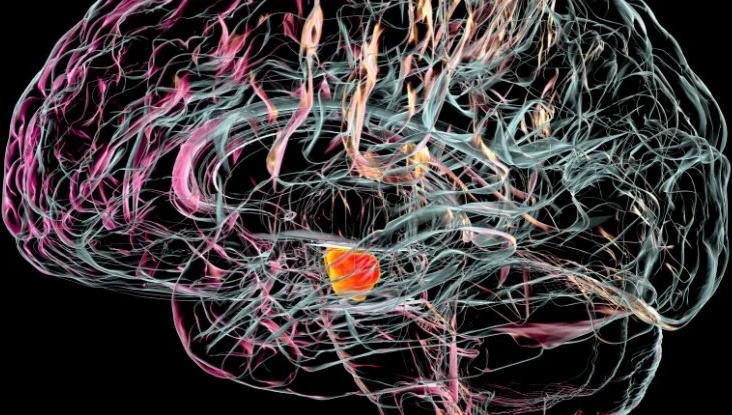Bilim İnsanları Parkinson Hastalığında Ölen Beyin Hücrelerini Saptadı