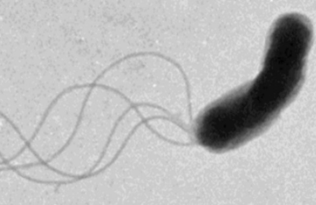 Bilim İnsanları, Uzun Yıllardan Sonra Bakterilerin Gerçekte Nasıl Hareket Ettiğini Anladı