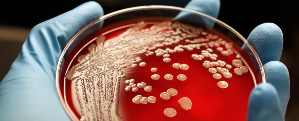 Bilim İnsanları İlaca Dirençli Enfeksiyonları Tedavi Etmek İçin Antibiyotik İçermeyen Bir Yol Buldu