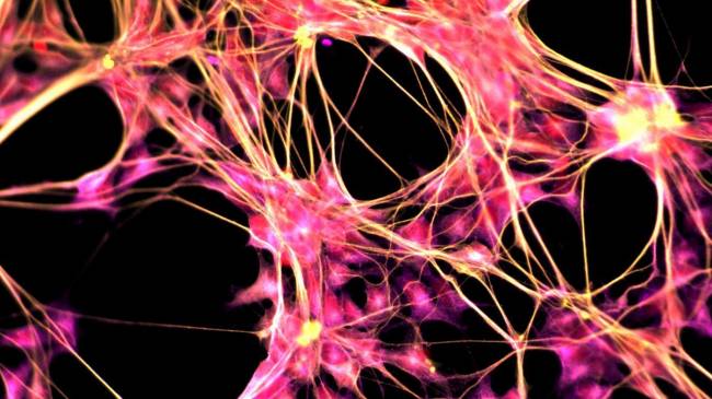 Yeni Bir Teknik İnsan Cildini Beyin Hücrelerine Dönüştürüyor