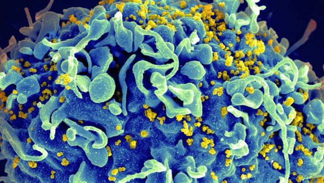 Gizlenmiş HIV virüslerini tespit edebilen bir biyoişaretçi bulundu